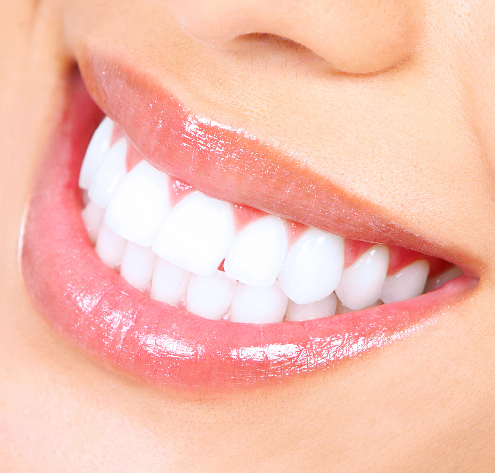 Teeth-Whitening